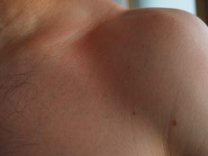 紫外線B波とA波の肌への影響とは？
